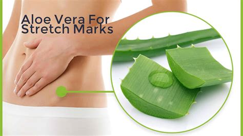 does aloe vera help stretch marks: An In-Depth Analysis and Unexpected Insights into Natural Remedies