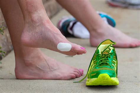 how to prevent blisters on arch of foot when running