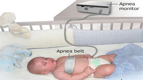 what does apnea mean on a hospital monitor: Delving into the Significance and Implications of Respiratory Distress in Medical Settings